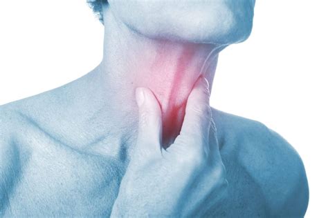 Sore Throat Pharyngitis Symptoms Treatment Diseasedr