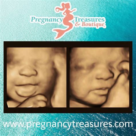 Adorable Ultrasound Pregnancy Treasures
