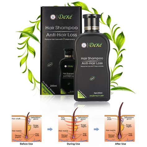 Best hair loss treatment for thicker hair: DEXE Anti-Hair Loss Hair Growth Sham (end 7/27/2018 3:15 PM)