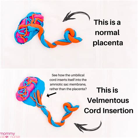 A Complete Guide To The Placenta And Umbilical Cord