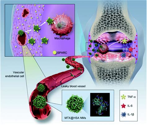 Application Of Nanomaterials In The Treatment Of Rheumatoid Arthritis
