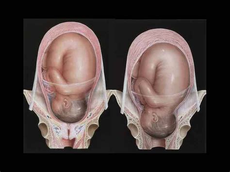 The Contracting Power Of The Uterus NOVA Birth Services