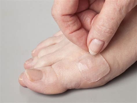 How To Treat Blisters On Feet During And After Hiking And Walking