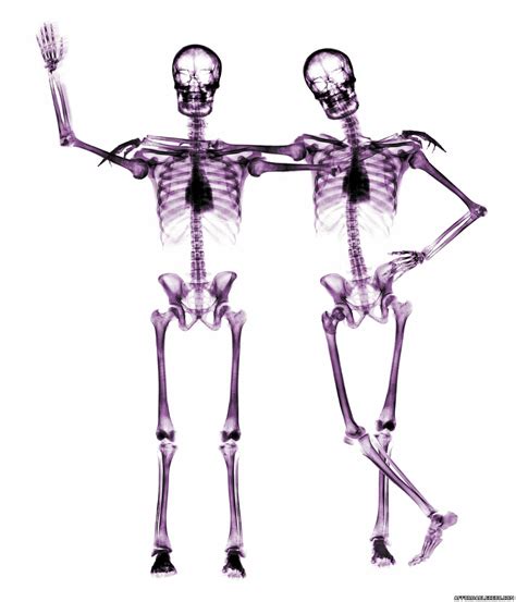 Picture Of Two Human Body Skeletons One Is Waving His Hand Saying Bye