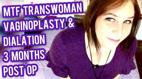 MTF Transwoman Vaginoplasty Dialation At 3 Months Post OP YouTube