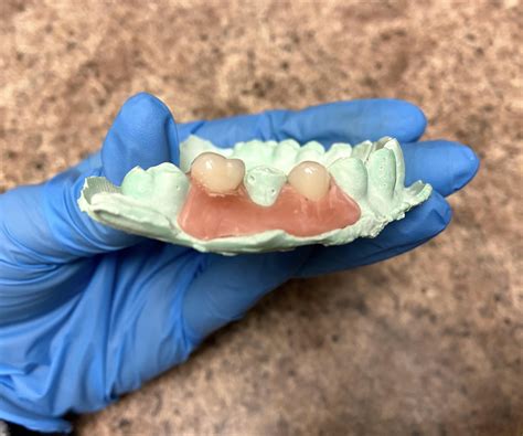 Diy False Teeth Diy Denture Kit Homemade Dentures Custom Full Or