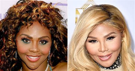 Look At That Massive Transformation Lil Kim Before And After Plastic