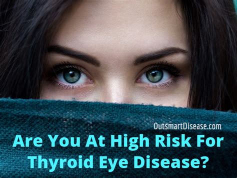 Are You At Risk For Thyroid Eye Disease