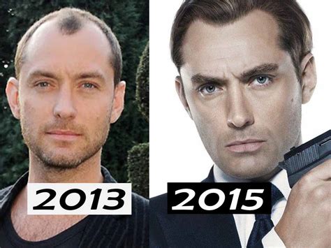 Did Jude Law Get A Hair Transplant Or Not Analysis By Matt Dominance