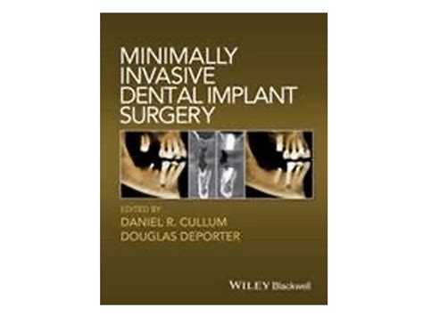 Minimally Invasive Dental Implant Surgery Osteogenics