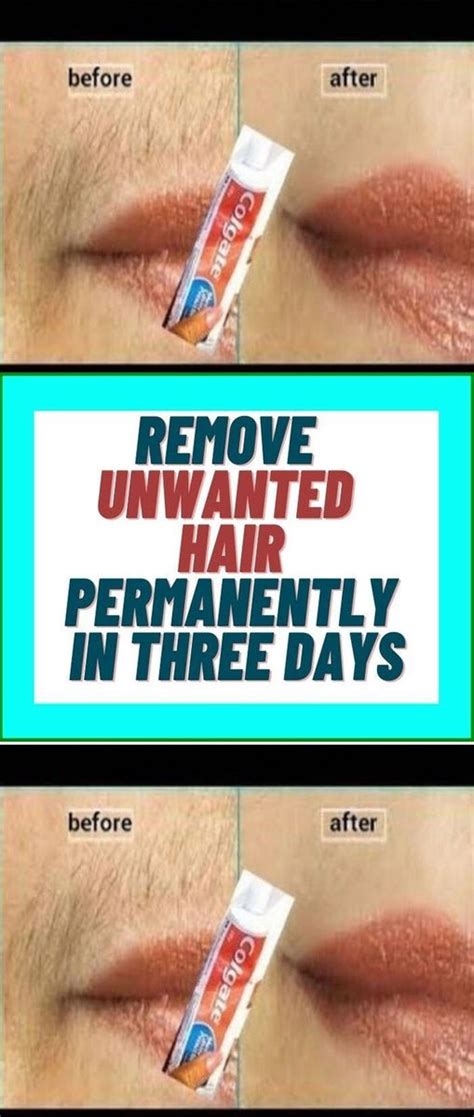 remove unwanted hair permanently in three days no shave no wax beautyfeed