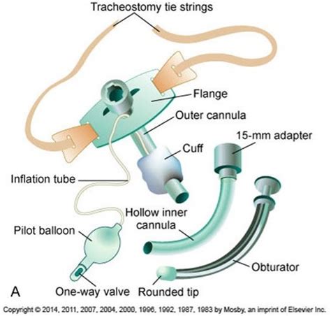 Tracheostomy Care And Suctioning Procedures Oral Nasal Pharyngeal