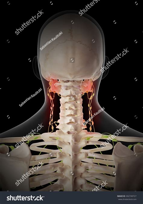 Medically Accurate Illustration Painful Lymphatic Nodes Stock