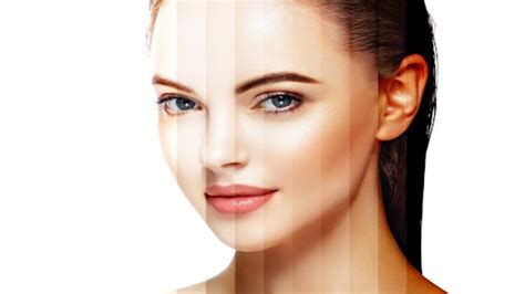 Uneven Skin Tone On Face Causes And Removal Tips