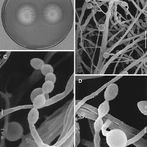 Pdf New Filamentous Fungus Sagenomella Chlamydospora Responsible For