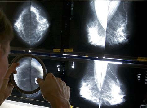 what age should women stop getting mammograms cbs news