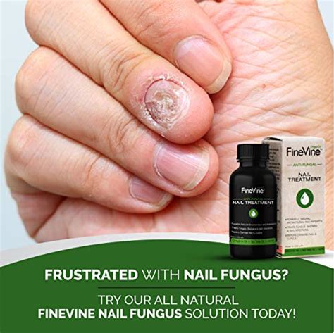Best Antifungal Nail Fungus Treatment Made In Usa For Toenail And