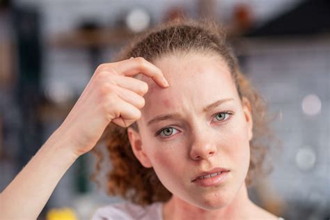 Itchy Forehead Causes Treatment And Prevention