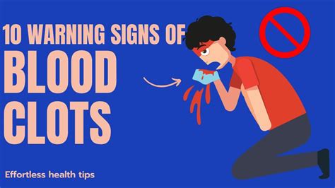 Top 10 Warning Signs Of Blood Clots You Should Not Ignore Youtube