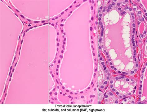 Histology Of Thyroid Gland
