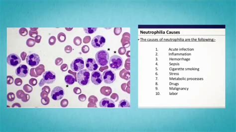 Disorder Of White Blood Cells Youtube