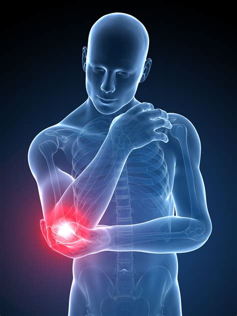 6 Effective Ways To Treat Elbow Tendonitis