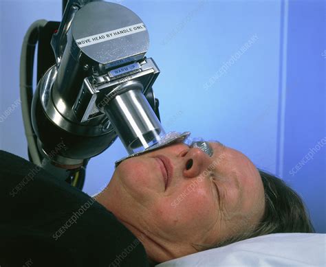 Radiotherapy Treatment Of Skin Cancer On Cheek Stock Image M705