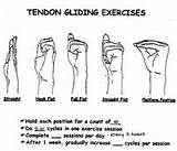 Carpal Tunnel Exercises Photos
