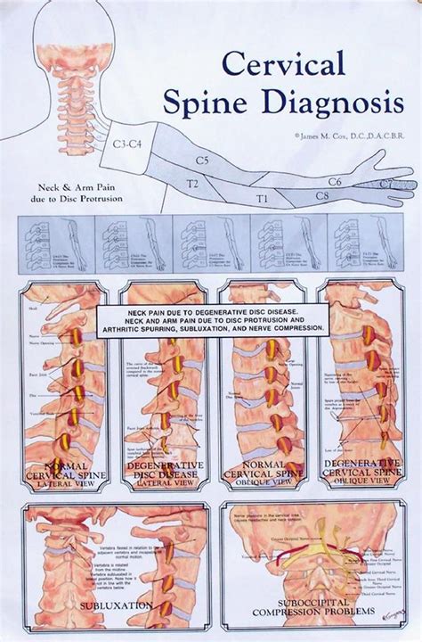 Cervical Spine Chart