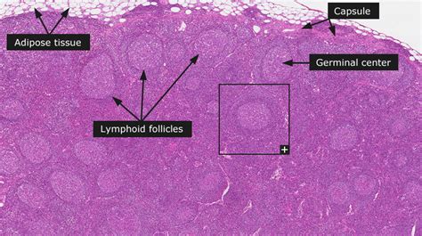 All About Lymph Node Follicles