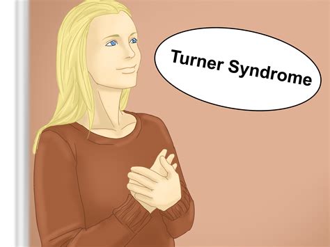 Como Diagnosticar a Síndrome de Turner 11 Passos