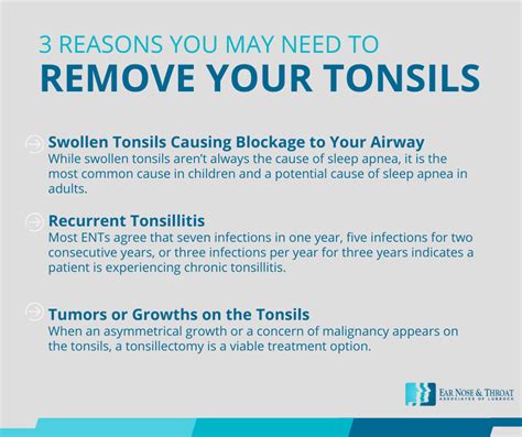 Ear Nose And Throat The Top 3 Reasons You May Need To Remove Your Tonsils