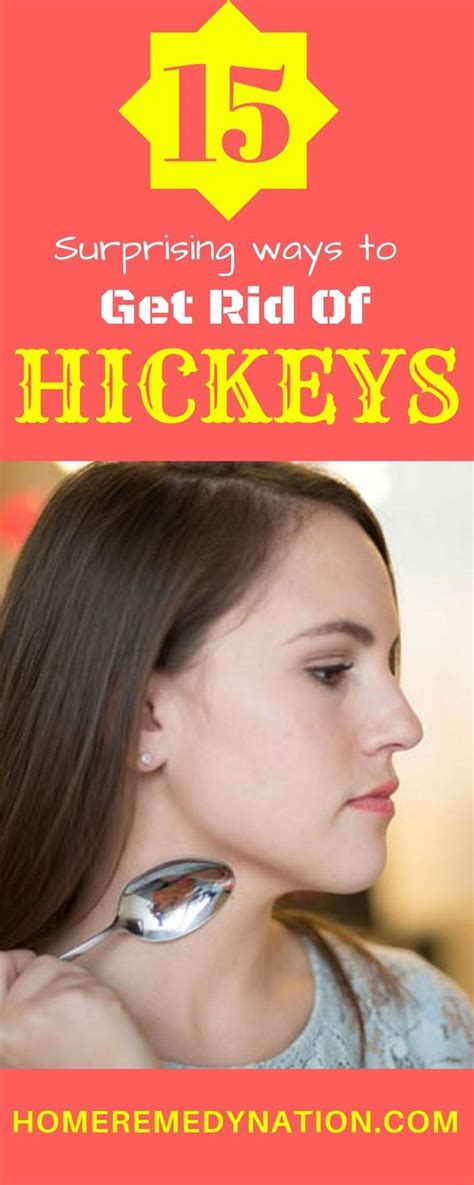 15 Home Remedies How To Get Rid Of A Hickey Fast And Overnight Home