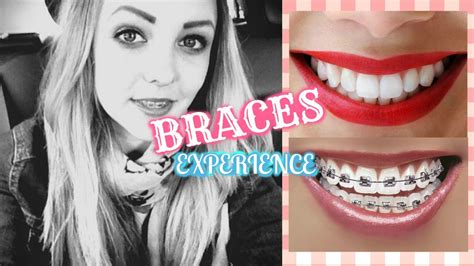 As an orthodontic patient, getting a regularly scheduled adjustment can cause teeth to change their position, which can make them more sensitive than normal, and more susceptible to pain and discomfort. Getting My Braces Experience- Care & Pain 101 ♡ - YouTube