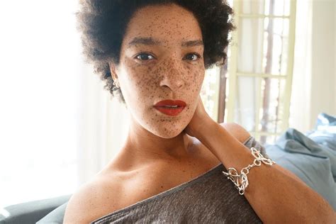 Model Nikia Phoenix Opens Up About Learning To Love Her Freckles Allure