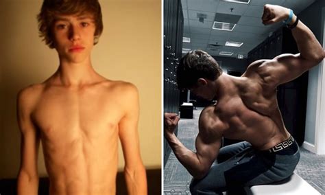 This Skinny Teenager S Transformation Over 3 Years Will Amaze You