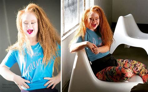 Model With Down Syndrome We Can Be Beautiful And Sexy Pictolic