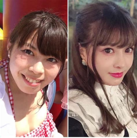 the female idol spent 5 years on plastic surgery and spent more than 7 million yen inews