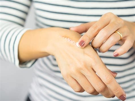Expert Talk Dermatologist Dr Kiran Godse Shares Tips To Reduce Scars