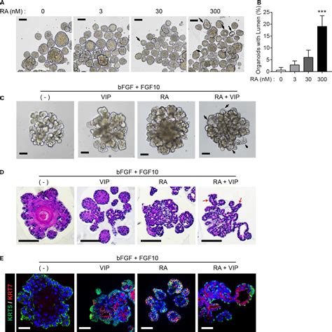 Frontiers 3d Organoid Culture From Adult Salivary Gland Tissues As An