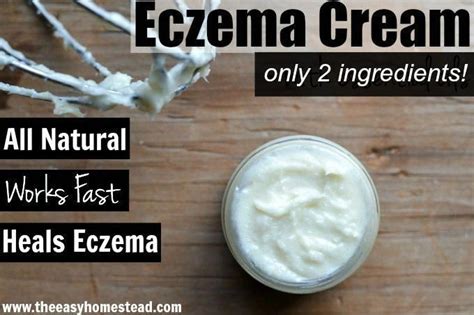 Homemade Eczema Cream Anti Itchcreams Eczema Cream Eczema Homemade
