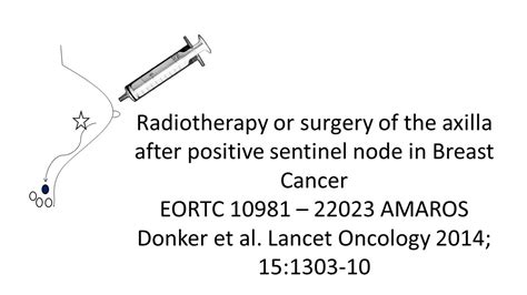 Radiation To Lymph Nodes Versus Axillary Dissection After Positive Slnb