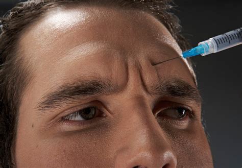 Botox Para Homens Eles Tamb M Precisam Entenda As Diferen As Metr Poles