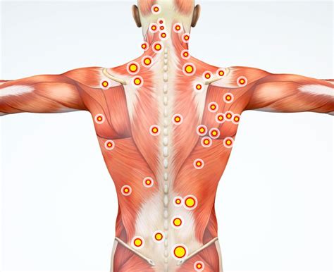 5 exercises to strengthen your lower back muscles. Spine Muscles in Pain? Myofascial Pain Syndrome May Be to Blame