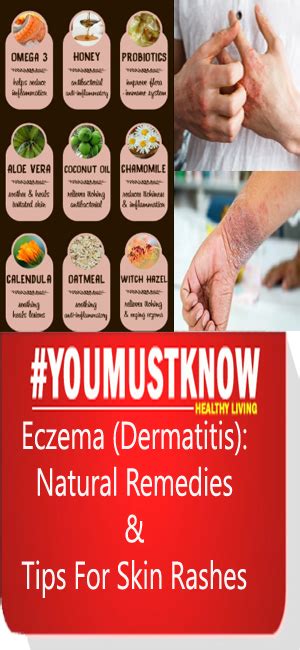 Eczema Dermatitis Natural Remedies And Tips For Skin