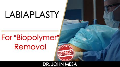 Labiaplasty For Removal Of Biopolymers Silicone Injections By