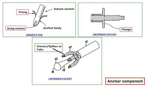 Bone And Suture Anchors Dolcerawiki