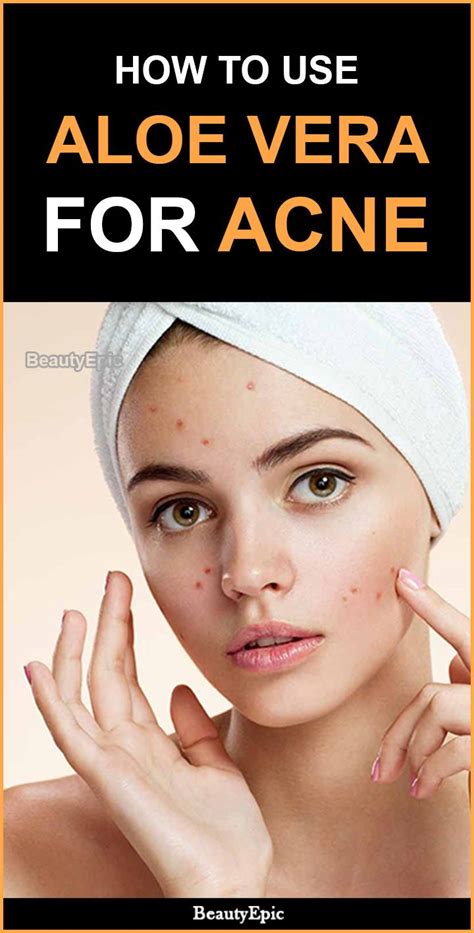 How To Use Aloe Vera For Acne Aloe Vera Skin Care Aloe Vera Acne