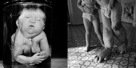 P., elevated frequency of glycophorin a mutations in erythrocytes from chernobyl accident victims. 15 Most Chilling Photos Of The Chernobyl Disaster