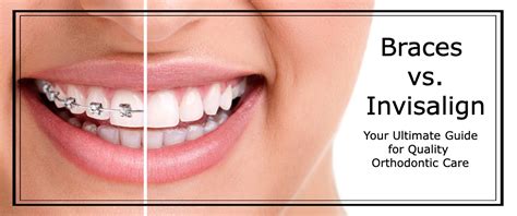 Invisalign Vs Braces Which Is Right For You Ultimate Guide